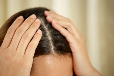 Healthy Scalp at Coco Hair Salon in Eastbourne